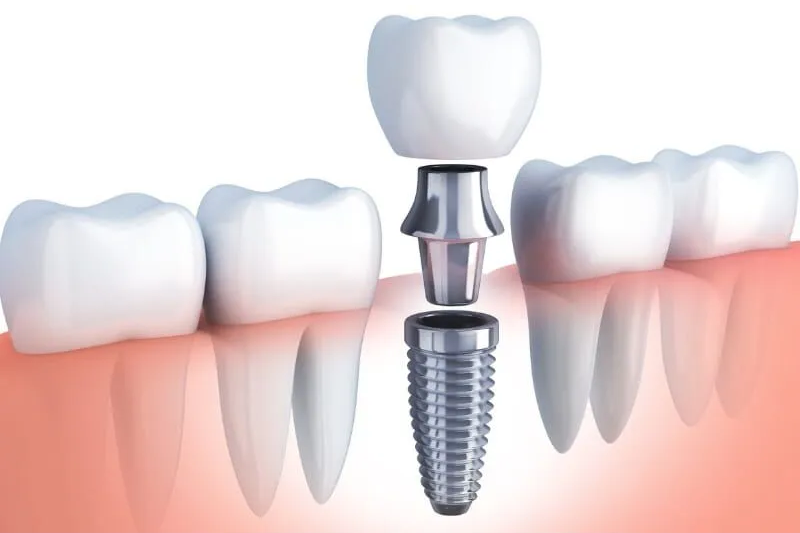 Dental Arts Dental