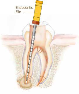 ORTHODONTIC TREATMENT