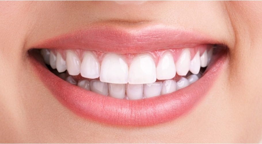 cosmetic dental