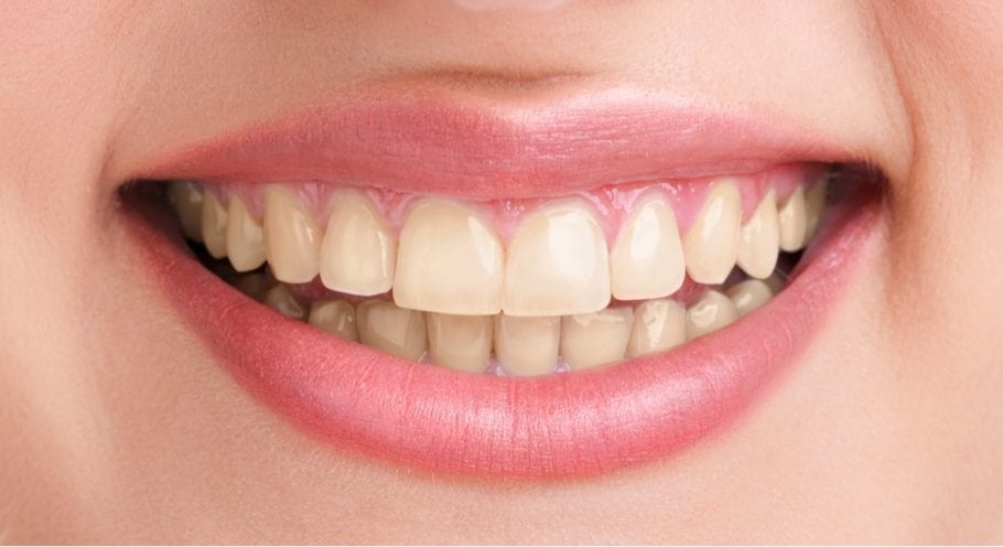 cosmetic dental
