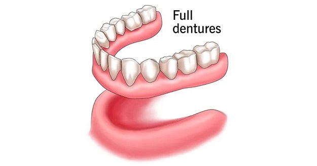 dentures partial