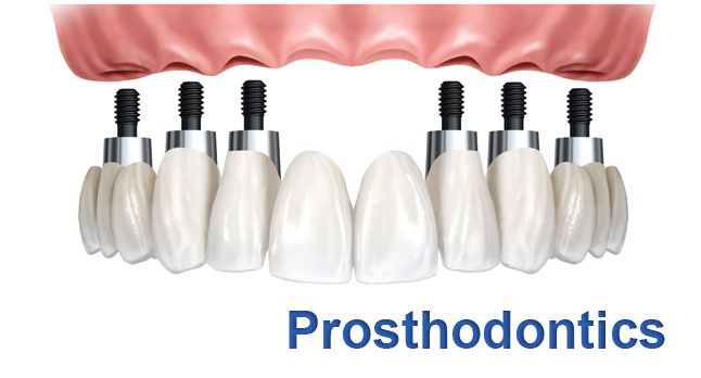 prosthodontics