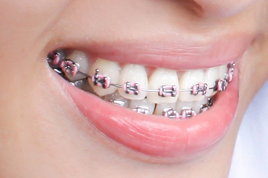 dental clinic in ghaziabad
